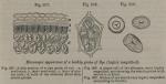 Fig. 207-209. Microscopic appearance of a healthy ...