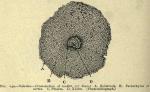 Fig. 240. Valerian - Cross-section of rootlet.