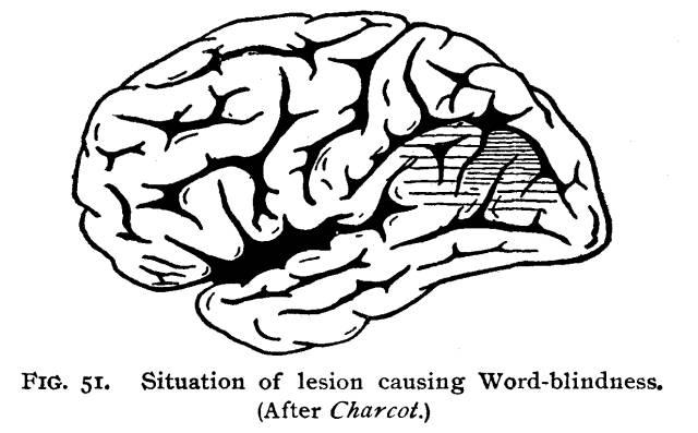 Figure 51. Situation of lesion