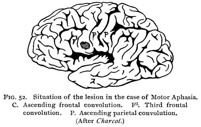 Figure 52. Situation of lesion