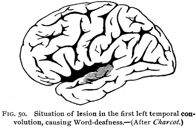 Figure 50. Situation of lesion