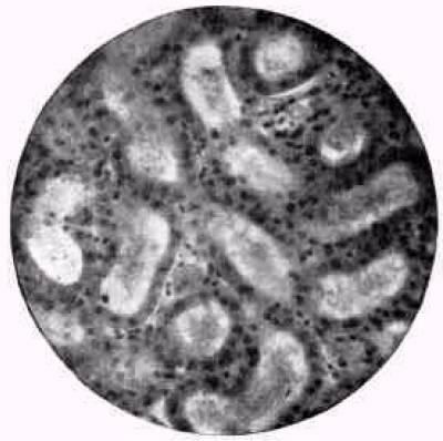 Figure 31. Cortex tubes.