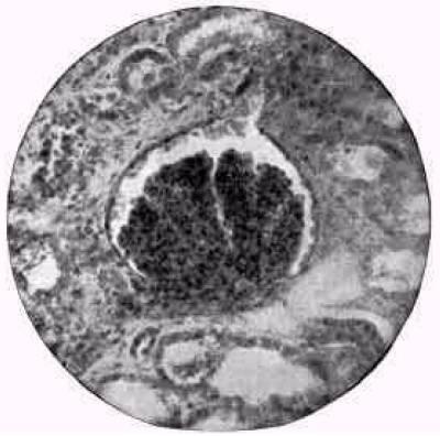 Figure 32. A glomerulus.