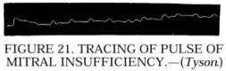 Figure 21. Tracing of Pulse