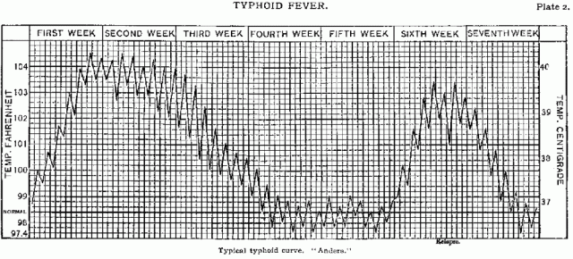 Plate 2: Typhoid Fever.