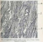 Fig. 2.—Longitudinal-tangential section of inner b...