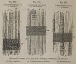 Fig. 331, 332, 333. Microscopic structure of the liber of C. calisaya, scrobiculata and pubescens.