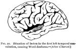 Figure 50. Situation of lesion